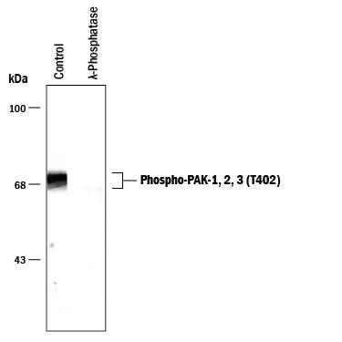Western blot of rat hippocampal lysate showing specific immunolabeling of the approximately 68-70 kDa PAK protein (Control). The phosphospecificity of this labeling is shown in the second lane ( lambda-phosphatase:  lambda  PPase). The blot is identical to the control except that it was incubated in  lambda  PPase (1200 units for 30 minutes) before being exposed to the anti-Phospho-PAK-1, 2, 3 (T402). The immunolabeling of PAK is completely eliminated by treatment with  lambda  PPase.