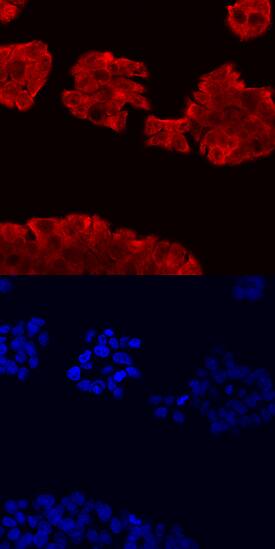 Immunocytochemistry PAR1/Thrombin Receptor Antibody [Unconjugated]