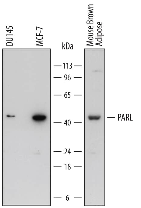 Western blot shows lysates of DU145 human prostate carcinoma cell line, MCF-7 human breast cancer cell line, and mouse brown adipose tissue. PVDF membrane was probed with 1 µg/mL of Sheep Anti-Human/Mouse/Rat PARL Antigen Affinity-purified Polyclonal Antibody (Catalog # AF7306) followed by HRP-conjugated Anti-Sheep IgG Secondary Antibody (Catalog # HAF016). A specific band was detected for PARL at approximately 42 kDa (as indicated). This experiment was conducted under reducing conditions and using Immunoblot Buffer Group 1.