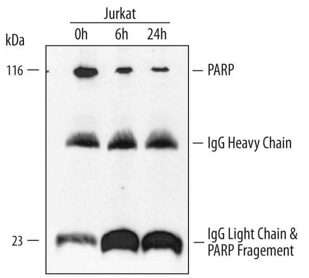 <b>Biological Strategies Validation. </b>Jurkat human acute T cell leukemia cell line was treated with apoptosis inducer anti-Fas for the indicated times. PARP was immunoprecipitated from cell lysates (1 - 2 x 106cells) following incubation with 5 µg Goat Anti-Human/Mouse PARP Antigen Affinity-purified Polyclonal Antibody (Catalog # AF-600-NA) for overnight at 4 °C. PARP-antibody complexes were absorbed using Protein G expressing Staph cells (Sigma). Immunoprecipitated PARP was detected by Western blot using 0.4 µg/mL Goat Anti-Human/Mouse PARP Antigen Affinity-purified Polyclonal Antibody (Catalog # AF-600-NA). View our recommended buffer recipes for immunoprecipitation.