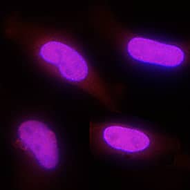 <b>Biological Strategies Validation. </b>PARP was detected in immersion fixed HeLa human cervical epithelial carcinoma cell line using Goat Anti-Human/Mouse PARP Antigen Affinity-purified Polyclonal Antibody (Catalog # AF-600-NA) at 1 µg/mL for 3 hours at room temperature. Cells were stained using the NorthernLights™ 557-conjugated Anti-Goat IgG Secondary Antibody (red; Catalog # NL001) and counterstained with DAPI (blue). Specific staining was localized to nuclei. View our protocol for Fluorescent ICC Staining of Cells on Coverslips.