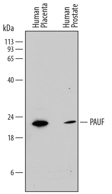 Western Blot PAUF/ZG16B Antibody (817310) [Unconjugated]