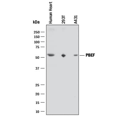 Western blot shows lysates of human heart tissue, 293T human embryonic kidney cell line, and A431 human epithelial carcinoma cell line. PVDF membrane was probed with 0.2 µg/mL of Sheep Anti-Human PBEF/Visfatin Antigen Affinity-purified Polyclonal Antibody (Catalog # AF4335) followed by HRP-conjugated Anti-Sheep IgG Secondary Antibody (Catalog # HAF016). A specific band was detected for PBEF/Visfatin at approximately 52 kDa (as indicated). This experiment was conducted under reducing conditions and using Immunoblot Buffer Group 1.