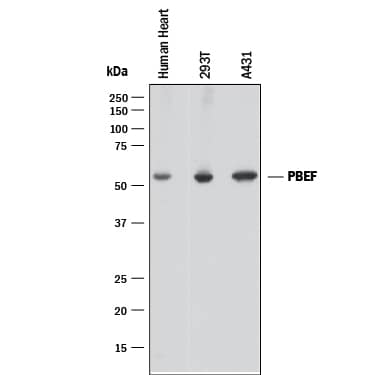 Western Blot PBEF/Visfatin/NAMPT Antibody (882104) [Unconjugated]