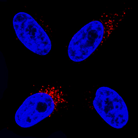 PBR was detected in immersion fixed HeLa human cervical epithelial carcinoma cell line using Rabbit Anti-Human/Mouse PBR Monoclonal Antibody (Catalog # MAB10045) at 3 µg/mL for 3 hours at room temperature. Cells were stained using the NorthernLights™ 557-conjugated Anti-Rabbit IgG Secondary Antibody (red; Catalog # NL004) and counterstained with DAPI (blue). Specific staining was localized to cytoplasm. View our protocol for Fluorescent ICC Staining of Cells on Coverslips.