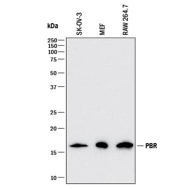 Western blot shows lysates of SK-OV-3 human ovarian adenocarcinoma cell line, MEF mouse embryonic feeder cells, and RAW 264.7 mouse monocyte/macrophage cell line. PVDF membrane was probed with 1 µg/mL of Rabbit Anti-Human/Mouse PBR Monoclonal Antibody (Catalog # MAB10045) followed by HRP-conjugated Anti-Rabbit IgG Secondary Antibody (Catalog # HAF008). A specific band was detected for PBR at approximately 18 kDa (as indicated). This experiment was conducted under reducing conditions and using Immunoblot Buffer Group 1.