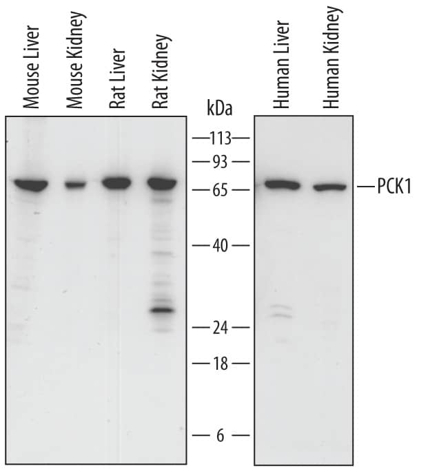 Western blot shows lysates of mouse liver tissue, mouse kidney tissue, rat liver tissue, rat kidney tissue, human liver tissue, and human kidney tissue. PVDF Membrane was probed with 0.2 µg/mL of Sheep Anti-Human/Mouse/Rat PCK1 Antigen Affinity-purified Polyclonal Antibody (Catalog # AF6787) followed by HRP-conjugated Anti-Sheep IgG Secondary Antibody (Catalog # HAF016). A specific band was detected for PCK1 at approximately 68 kDa (as indicated). This experiment was conducted under reducing conditions and using Immunoblot Buffer Group 1.