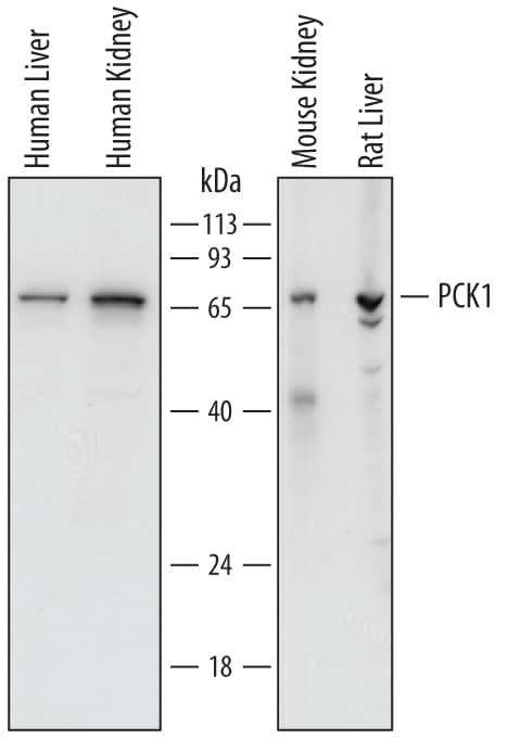 Western blot shows lysates of human liver tissue, human kidney tissue, mouse kidney tissue, and rat liver tissue. PVDF membrane was probed with 1 µg/mL of Sheep Anti-Human/Mouse/Rat PCK1 Antigen Affinity-purified Polyclonal Antibody (Catalog # AF7316) followed by HRP-conjugated Anti-Sheep IgG Secondary Antibody (Catalog # HAF016). A specific band was detected for PCK1 at approximately 68 kDa (as indicated). This experiment was conducted under reducing conditions and using Immunoblot Buffer Group 1.