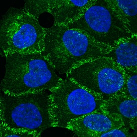 Immunocytochemistry P-Cadherin Antibody [Unconjugated]