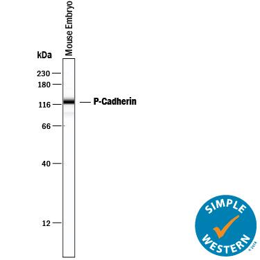 Simple Western P-Cadherin Antibody [Unconjugated]