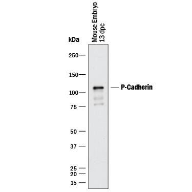Western Blot P-Cadherin Antibody [Unconjugated]