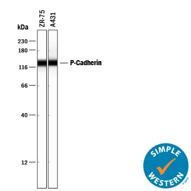 Simple Western lane view shows lysates of ZR-75 human breast cancer cell line and A431 human epithelial carcinoma cell line, loaded at 0.2 mg/mL. A specific band was detected for P-Cadherin at approximately 135 kDa (as indicated) using 10 µg/mL of Goat Anti-Human P-Cadherin Antigen Affinity-purified Polyclonal Antibody (Catalog # AF861) followed by 1:50 dilution of HRP-conjugated Anti-Goat IgG Secondary Antibody (Catalog # HAF109). This experiment was conducted under reducing conditions and using the 12-230 kDa separation system.