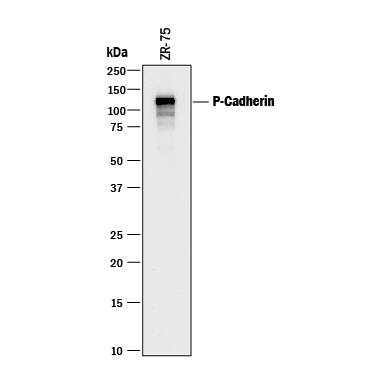 Western blot shows lysate of ZR-75 human breast cancer cell line. PVDF membrane was probed with 1 µg/mL of Goat Anti-Human P-Cadherin Antigen Affinity-purified Polyclonal Antibody (Catalog # AF861) followed by HRP-conjugated Anti-Goat IgG Secondary Antibody (Catalog # HAF017). A specific band was detected for P-Cadherin at approximately 120 kDa (as indicated). This experiment was conducted under reducing conditions and using Immunoblot Buffer Group 1.