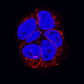 P-Cadherin was detected in immersion fixed MCF-7 human breast cancer cell line using Mouse Anti-Human P-Cadherin Monoclonal Antibody (Catalog # MAB861R) at 25 µg/mL for 3 hours at room temperature. Cells were stained using the NorthernLights™ 557-conjugated Anti-Mouse IgG Secondary Antibody (red; Catalog # NL007) and counterstained with DAPI (blue). Specific staining was localized to cytoplasm. View our protocol for Fluorescent ICC Staining of Cells on Coverslips.