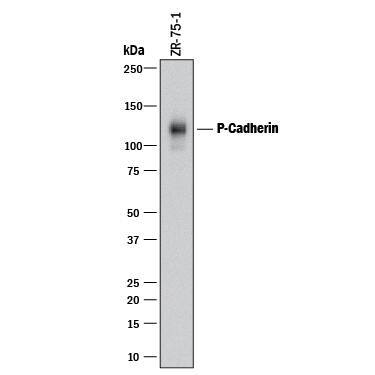 Western blot shows lysates of ZR-75-1 human breast cancer cell line. PVDF membrane was probed with 1 µg/mL of Mouse Anti-Human P-Cadherin Monoclonal Antibody (Catalog # MAB861R) followed by HRP-conjugated Anti-Mouse IgG Secondary Antibody (Catalog # HAF018). A specific band was detected for P-Cadherin at approximately 120 kDa (as indicated). This experiment was conducted under reducing conditions and using Immunoblot Buffer Group 1.