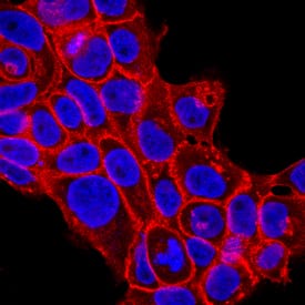 Immunocytochemistry P-Cadherin Antibody (104805) [Unconjugated]
