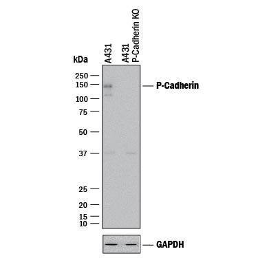 Knockout Validated P-Cadherin Antibody (104805) [Unconjugated]