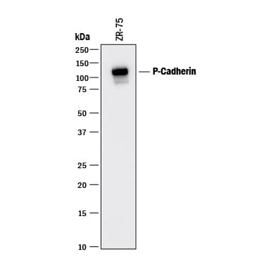 Western Blot P-Cadherin Antibody (104805) [Unconjugated]