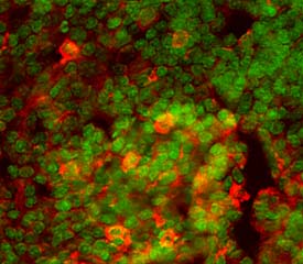 PD‑1 was detected in perfusion fixed frozen sections of mouse thymus using 15 &micro;g/mL Mouse PD‑1 Antigen Affinity-purified Polyclonal Antibody (Catalog # AF1021) overnight at 4 &deg;C. Tissue was stained (red) and counterstained (green). View our protocol for Fluorescent IHC Staining of Frozen Tissue Sections.