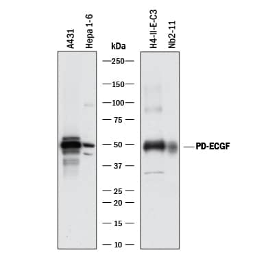 Western blot shows lysates of A431 human epithelial carcinoma cell line, Hepa 1-6 mouse hepatoma cell line, H4-II-E-C3 rat hepatoma cell line, and Nb2-11 rat lymphoma cell line. PVDF membrane was probed with 1 µg/mL of Sheep Anti-Human/Mouse/Rat PD-ECGF/Thymidine Phosphorylase Antigen Affinity-purified Polyclonal Antibody (Catalog # AF7568) followed by HRP-conjugated Anti-Sheep IgG Secondary Antibody (Catalog # HAF016). A specific band was detected for PD-ECGF/Thymidine Phosphorylase at approximately 49 kDa (as indicated). This experiment was conducted under reducing conditions and using Immunoblot Buffer Group 1.