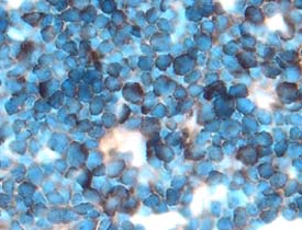 PD-L2 was detected in perfusion fixed frozen sections of mouse thymus using 15 µg/mL Goat Anti-Mouse PD-L2 Antigen Affinity-purified Polyclonal Antibody (Catalog # AF1022) overnight at 4 °C. Tissue was stained with the Anti-Goat HRP-DAB Cell & Tissue Staining Kit (brown; Catalog # CTS008) and counterstained with hematoxylin (blue). View our protocol for Chromogenic IHC Staining of Frozen Tissue Sections.