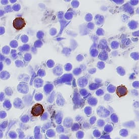 PD-1 was detected in perfusion fixed frozen sections of mouse spleen using Goat Anti-Mouse PD-1 Antigen Affinity-purified Polyclonal Antibody (Catalog # AF1021) at 5 µg/mL overnight at 4 °C. Tissue was stained using the Anti-Goat HRP-DAB Cell & Tissue Staining Kit (brown; Catalog # CTS008) and counterstained with hematoxylin (blue). Specific staining was localized to cytoplasm in splenocytes. View our protocol for Chromogenic IHC Staining of Frozen Tissue Sections.