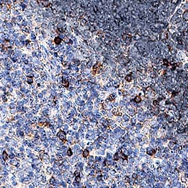 PD-1 was detected in perfusion fixed paraffin-embedded sections of mouse thymus using Goat Anti-Mouse PD-1 Antigen Affinity-purified Polyclonal Antibody (Catalog # AF1021) at 1.7 µg/mL for 1 hour at room temperature followed by incubation with the Anti-Goat IgG VisUCyte™ HRP Polymer Antibody (Catalog # VC004). Before incubation with the primary antibody, tissue was subjected to heat-induced epitope retrieval using Antigen Retrieval Reagent-Basic (Catalog # CTS013). Tissue was stained using DAB (brown) and counterstained with hematoxylin (blue). Specific staining was localized to cell membranes. View our protocol for IHC Staining with VisUCyte HRP Polymer Detection Reagents.