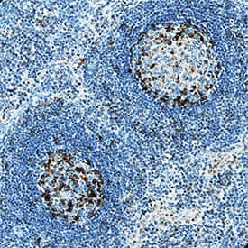 PD-1 was detected in immersion fixed paraffin-embedded sections of human lymph node using Goat Anti-Human PD-1 Antigen Affinity-purified Polyclonal Antibody (Catalog # AF1086) at 3 µg/mL overnight at 4 °C. Tissue was stained using the Anti-Goat HRP-DAB Cell & Tissue Staining Kit (brown; Catalog # CTS008) and counterstained with hematoxylin (blue). Specific staining was localized to lymphocytes. View our protocol for Chromogenic IHC Staining of Paraffin-embedded Tissue Sections.