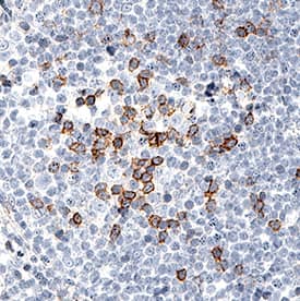 PD-1 was detected in immersion fixed paraffin-embedded sections of human tonsil using Mouse Anti-Human PD-1 Monoclonal Antibody (Catalog # MAB10864) at 5 µg/mL for 1 hour at room temperature followed by incubation with the Anti-Mouse IgG VisUCyte™ HRP Polymer Antibody (Catalog # VC001). Before incubation with the primary antibody, tissue was subjected to heat-induced epitope retrieval using Antigen Retrieval Reagent-Basic (Catalog # CTS013). Tissue was stained using DAB (brown) and counterstained with hematoxylin (blue). Specific staining was localized to lymphocytes. View our protocol for IHC Staining with VisUCyte HRP Polymer Detection Reagents.