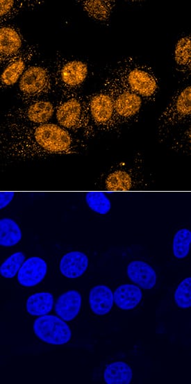 PDCD4 was detected in immersion fixed MCF-7 human breast cancer cell line using Sheep Anti-Human PDCD4 Antigen Affinity-purified Polyclonal Antibody (Catalog # AF7019) at 1.7 µg/mL for 3 hours at room temperature. Cells were stained using the NorthernLights™ 557-conjugated Anti-Sheep IgG Secondary Antibody (yellow, upper panel; Catalog # NL010) and counterstained with DAPI (blue, lower panel). Specific staining was localized to nuclei. View our protocol for Fluorescent ICC Staining of Cells on Coverslips.