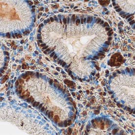 PDCD4 was detected in immersion fixed paraffin-embedded sections of human stomach using Sheep Anti-Human PDCD4 Antigen Affinity-purified Polyclonal Antibody (Catalog # AF7019) at 3 µg/mL overnight at 4 °C. Tissue was stained using the Anti-Sheep HRP-DAB Cell & Tissue Staining Kit (brown; Catalog # CTS019) and counterstained with hematoxylin (blue). Specific staining was localized to nuclei in epithelial cells. View our protocol for Chromogenic IHC Staining of Paraffin-embedded Tissue Sections.