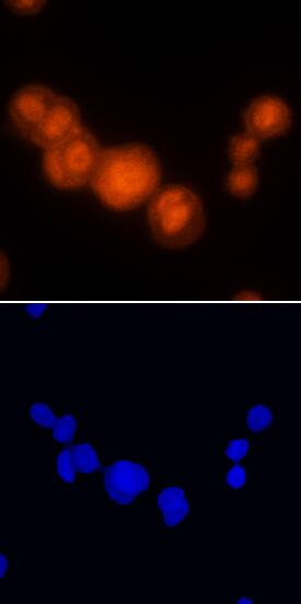 PDCD4 was detected in immersion fixed MCF-7 human breast cancer cell line using Mouse Anti-Human PDCD4 Monoclonal Antibody (Catalog # MAB7019) at 25 µg/mL for 3 hours at room temperature. Cells were stained using the NorthernLights™ 557-conjugated Anti-Mouse IgG Secondary Antibody (red; Catalog # NL007) and counterstained with DAPI (blue). Specific staining was localized to nuclei and cytoplasm. View our protocol for Fluorescent ICC Staining of Cells on Coverslips.