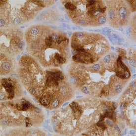 Immunohistochemistry PDCD5 Antibody (728906)