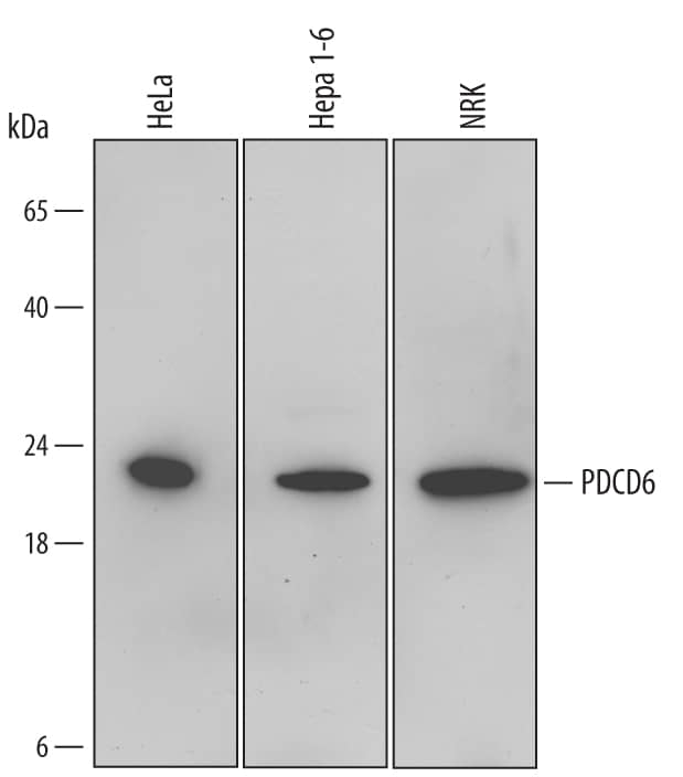 Western blot shows lysates of HeLa human cervical epithelial carcinoma cell line, Hepa 1-6 mouse hepatoma cell line, and NRK rat normal kidney cell line. PVDF Membrane was probed with 1 µg/mL of Sheep Anti-Human/Mouse/Rat PDCD6 Polyclonal Antibody (Catalog # AF6015) followed by HRP-conjugated Anti-Sheep IgG Secondary Antibody (Catalog # HAF016). A specific band was detected for PDCD6 at approximately 22 kDa (as indicated). This experiment was conducted under reducing conditions and using Immunoblot Buffer Group 2.