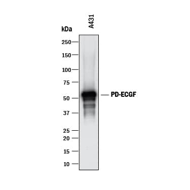 Western blot shows lysates of A431 human epithelial carcinoma cell line. PVDF membrane was probed with 0.1 µg/mL of Goat Anti-Human PD-ECGF/Thymidine Phosphorylase Antigen Affinity-purified Polyclonal Antibody (Catalog # AF1143) followed by HRP-conjugated Anti-Goat IgG Secondary Antibody (Catalog # HAF017). A specific band was detected for PD-ECGF/Thymidine Phosphorylase at approximately 49 kDa (as indicated). This experiment was conducted under reducing conditions and using Immunoblot Buffer Group 1.