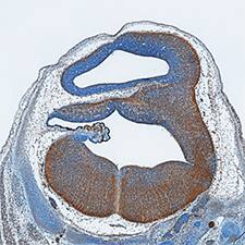 PD-ECGF/Thymidine Phosphorylase was detected in immersion fixed frozen sections of mouse embryonic brain (13 d.p.c.) using Sheep Anti-Human/Mouse/Rat PD-ECGF/Thymidine Phosphorylase Antigen Affinity-purified Polyclonal Antibody (Catalog # AF7568) at 5 µg/mL overnight at 4 °C. Tissue was stained using the Anti-Sheep HRP-DAB Cell & Tissue Staining Kit (brown; Catalog # CTS019) and counterstained with hematoxylin (blue). Specific staining was localized to plasma membrane. View our protocol for Chromogenic IHC Staining of Frozen Tissue Sections.