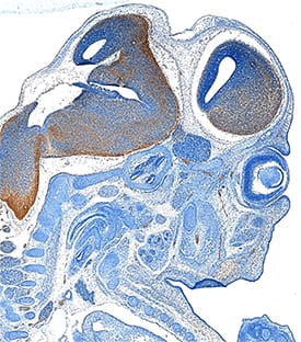 PD-ECGF/Thymidine Phosphorylase was detected in immersion fixed frozen sections of mouse embryo (15 d.p.c.) using Rat Anti-Human/Mouse/Rat PD-ECGF/Thymidine Phosphorylase Monoclonal Antibody (Catalog # MAB7568) at 25 µg/mL overnight at 4 °C. Tissue was stained using the Anti-Rat HRP-DAB Cell & Tissue Staining Kit (brown; Catalog # CTS017) and counterstained with hematoxylin (blue). Specific staining was localized to developing brain. View our protocol for Chromogenic IHC Staining of Frozen Tissue Sections.