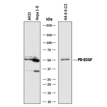 Western blot shows lysates of A431 human epithelial carcinoma cell line, Hepa 1-6 mouse hepatoma cell line, and H4-II-E-C3 rat hepatoma cell line. PVDF membrane was probed with 2 µg/mL of Rat Anti-Human/Mouse/Rat PD-ECGF/Thymidine Phosphorylase Monoclonal Antibody (Catalog # MAB7568) followed by HRP-conjugated Anti-Rat IgG Secondary Antibody (Catalog # HAF005). A specific band was detected for PD-ECGF/Thymidine Phosphorylase at approximately 49 kDa (as indicated). This experiment was conducted under reducing conditions and using Immunoblot Buffer Group 1.