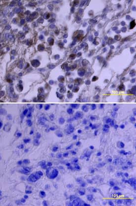 Immunohistochemistry PDGFR alpha Antibody