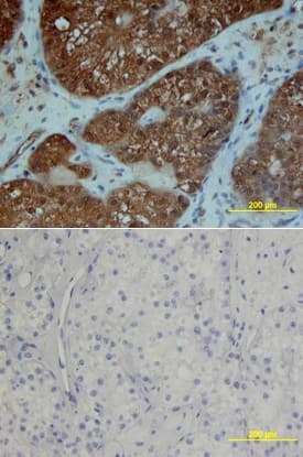 Immunohistochemistry PDGFR alpha Antibody
