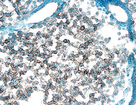 PDGF Ra was detected in immersion fixed frozen sections of mouse embryo using 15 µg/mL Goat Anti-Mouse PDGF Ra Antigen Affinity-purified Polyclonal Antibody (Catalog # AF1062) overnight at 4 °C. Tissue was stained with the Anti-Goat HRP-DAB Cell & Tissue Staining Kit (brown; CTS008) and counterstained with hematoxylin (blue). Specific labeling was localized to the plasma membrane of mesenchymal cells. View our protocol for Chromogenic IHC Staining of Frozen Tissue Sections.