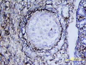 Immunohistochemistry PDGFR alpha Antibody [Unconjugated]