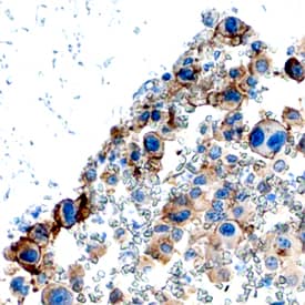 Immunohistochemistry PDGFR alpha Antibody