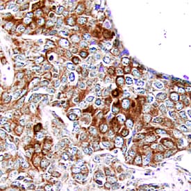 Immunohistochemistry PDGFR alpha Antibody (35248) [Unconjugated]