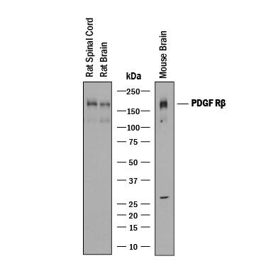 Western blot shows lysates of rat spinal cord tissue, rat brain tissue, and mouse brain tissue. PVDF membrane was probed with 0.25 µg/mL of Goat Anti-Mouse PDGF R beta  Antigen Affinity-purified Polyclonal Antibody (Catalog # AF1042) followed by HRP-conjugated Anti-Goat IgG Secondary Antibody (Catalog # HAF019). A specific band was detected for PDGF R beta  at approximately 190 kDa (as indicated). This experiment was conducted under reducing conditions and using Immunoblot Buffer Group 1.
