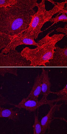 <b>Biological Strategies Validation. </b>PDGF R beta  phosphorylated at Y751 was detected in immersion fixed BJ human skin fibroblast cell line stimulated (top panel), and unstimulated (bottom panel), with Recombinant Human PDGF-BB (Catalog # 220-BB) using Rabbit Anti-Human/Mouse Phospho-PDGF R beta  (Y751) Monoclonal Antibody (Catalog # MAB9027) at 5 µg/mL for 3 hours at room temperature. Cells were stained using the NorthernLights™ 557-conjugated Anti-Rabbit IgG Secondary Antibody (red; Catalog # NL004) and counterstained with DAPI (blue). Specific staining was localized to cell surfaces and cytoplasm. View our protocol for Fluorescent ICC Staining of Cells on Coverslips.