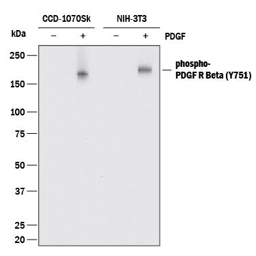 Western blot shows lysates of CCD-1070Sk human foreskin fibroblast cell line and NIH-3T3 mouse embryonic fibroblast cell line untreated (-) or treated (+) with 100 ng/mL Recombinant Human PDGF-BB (Catalog # 220-BB) for 20 minutes. PVDF membrane was probed with 0.1 µg/mL of Rabbit Anti-Human/Mouse Phospho-PDGF R beta  (Y751) Monoclonal Antibody (Catalog # MAB9027) followed by HRP-conjugated Anti-Rabbit IgG Secondary Antibody (Catalog # HAF008). A specific band was detected for PDGF R beta  at approximately 190 kDa (as indicated). This experiment was conducted under reducing conditions and using Immunoblot Buffer Group 1.