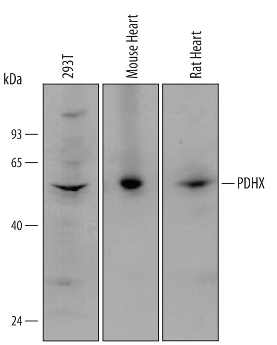 Western blot shows lysates of 293T human embryonic kidney cell line, mouse heart tissue, and rat heart tissue. PVDF Membrane was probed with 1 µg/mL of Goat Anti-Human/Mouse/Rat PDHX Polyclonal Antibody (Catalog # AF6014) followed by HRP-conjugated Anti-Goat IgG Secondary Antibody (Catalog # HAF109). A specific band was detected for PDHX at approximately 55 kDa (as indicated). This experiment was conducted under reducing conditions and using Immunoblot Buffer Group 1.