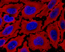 Immunocytochemistry PDK-1 Antibody (650308) [Unconjugated]