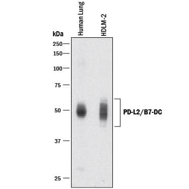 Western blot shows lysates of human lung tissue and HDLM-2 human Hodgkin's lymphoma cell line. PVDF membrane was probed with 2 µg/mL of Goat Anti-Human PD-L2/B7-DC Antigen Affinity-purified Polyclonal Antibody (Catalog # AF1224) followed by HRP-conjugated Anti-Goat IgG Secondary Antibody (Catalog # HAF017). Specific bands were detected for PD-L2/B7-DC at approximately 45-50 kDa (as indicated). This experiment was conducted under reducing conditions and using Immunoblot Buffer Group 1.